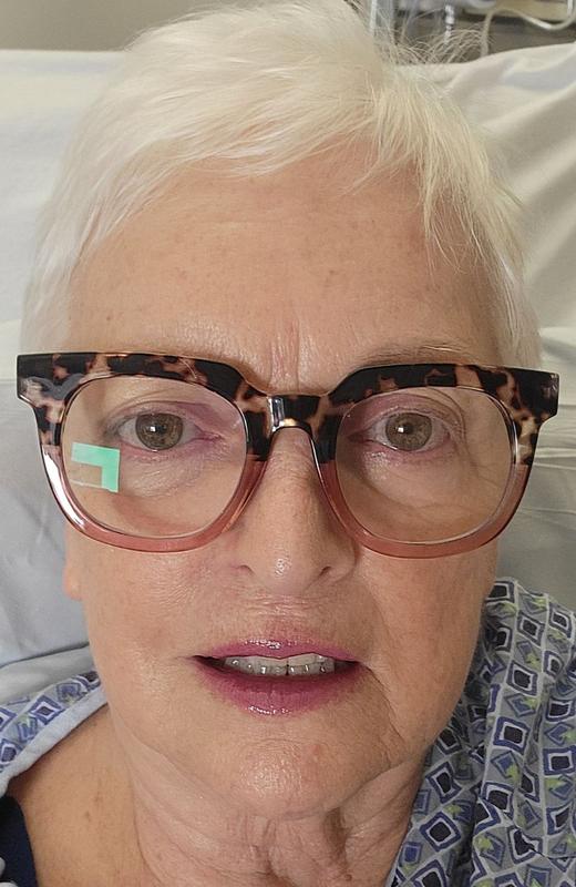 Customer photo for "Minimized my 80 year old skin imperfections"