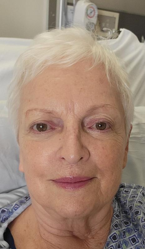 Customer photo for "Minimized my 80 year old skin imperfections"