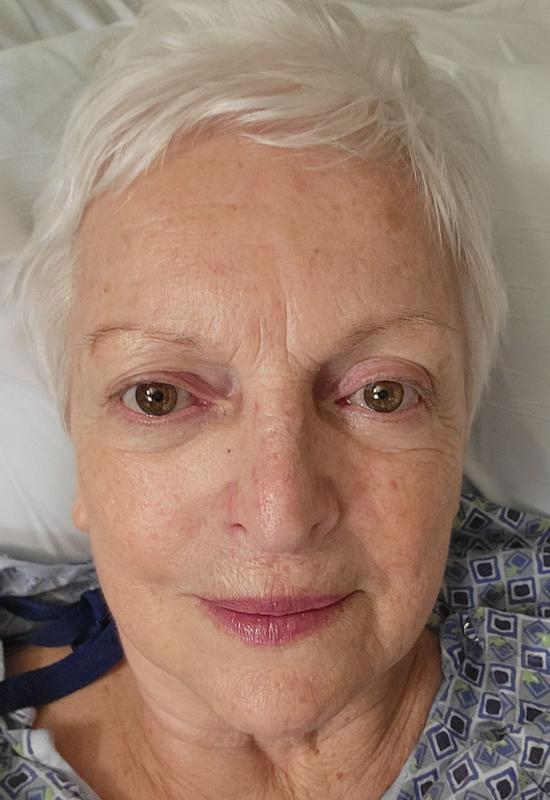 Customer photo for "Minimized my 80 year old skin imperfections"