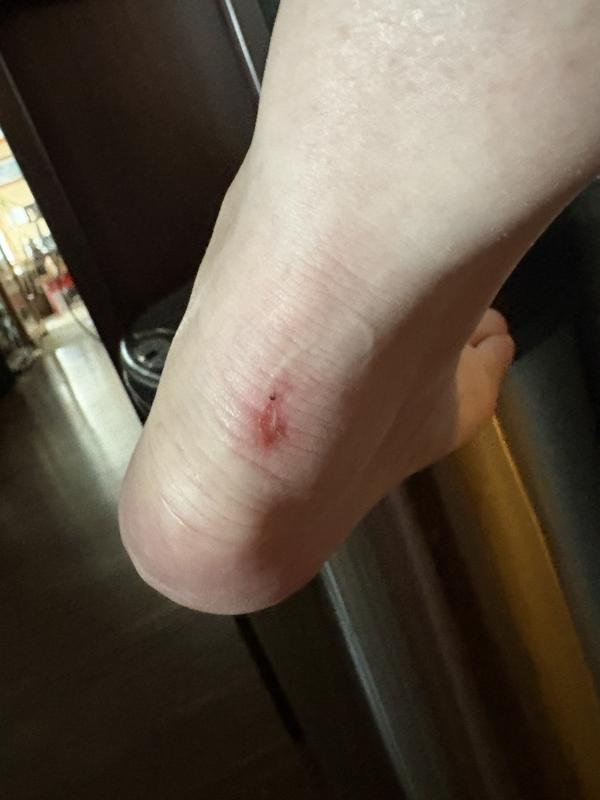 Photo submitted with review of product
