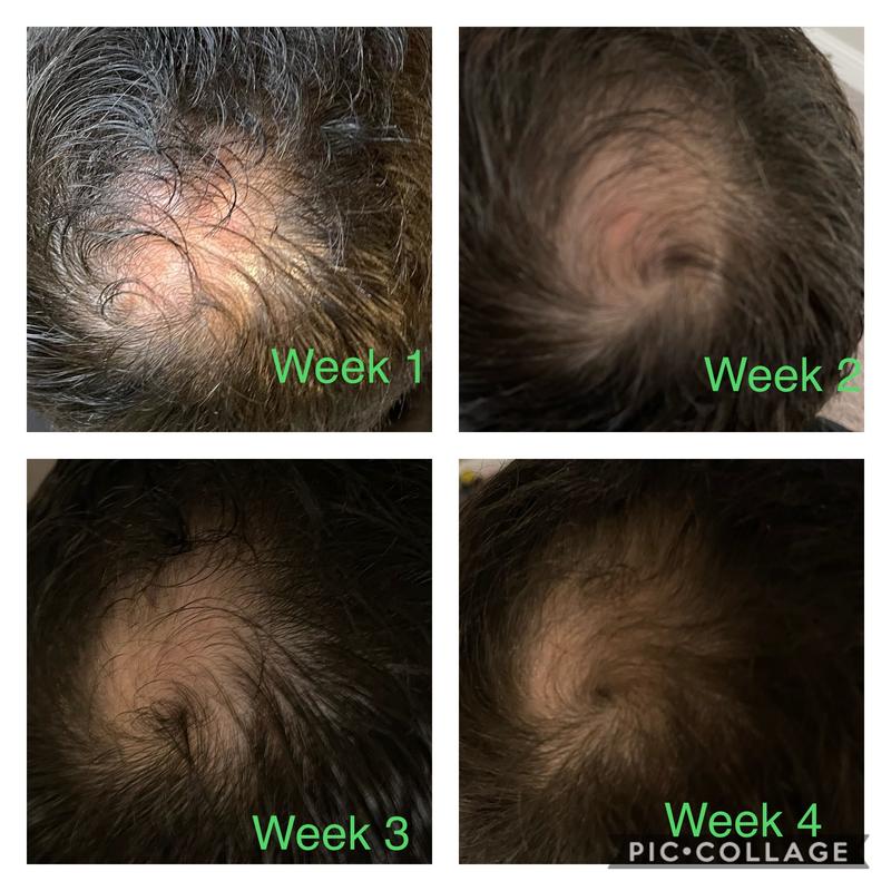Customer photo for "Works great for thinning ontop for men"