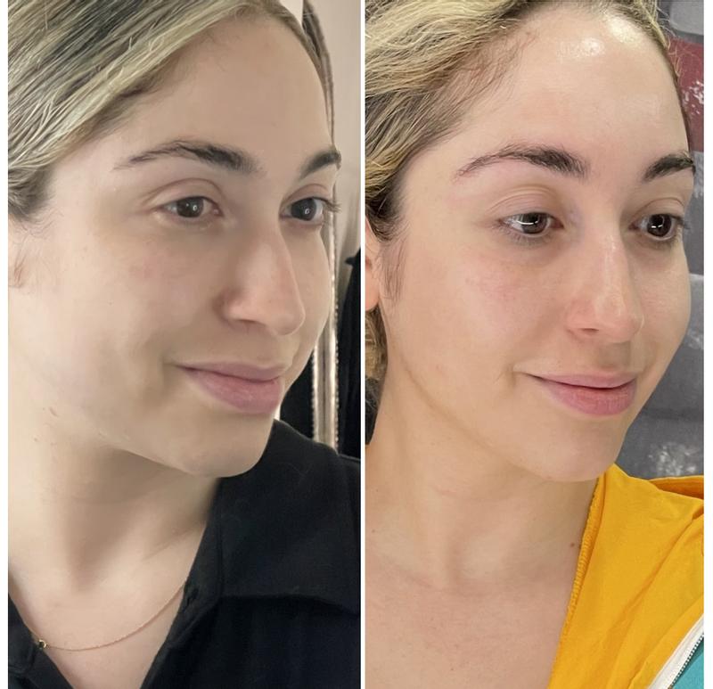 Customer photo for "Amazing Results"