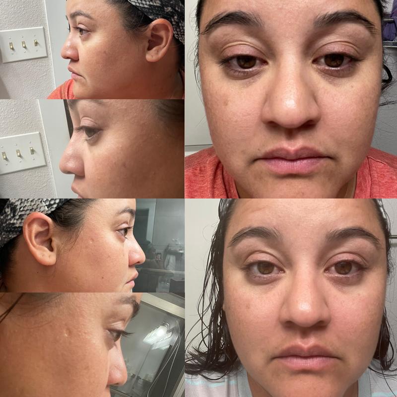 Review Thumbnail Image 0 258068135