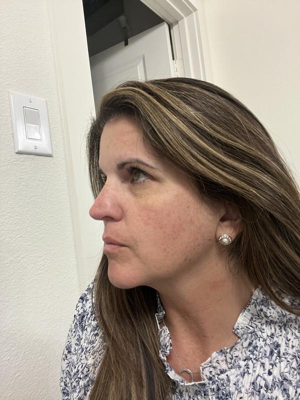 Customer photo for "Fine lines be gone!"