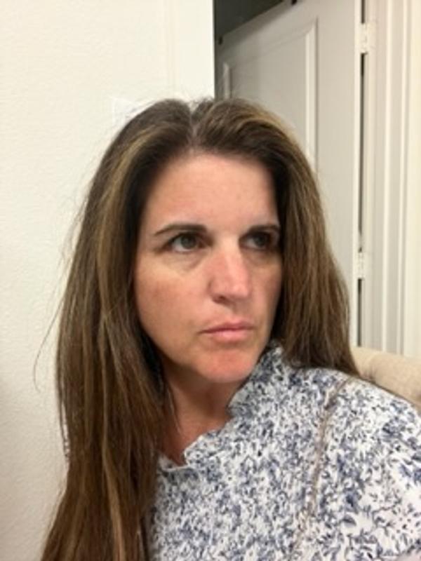 Customer photo for "Fine lines be gone!"