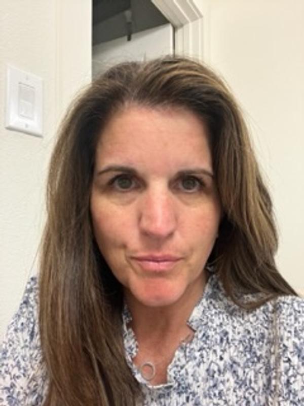 Customer photo for "Fine lines be gone!"
