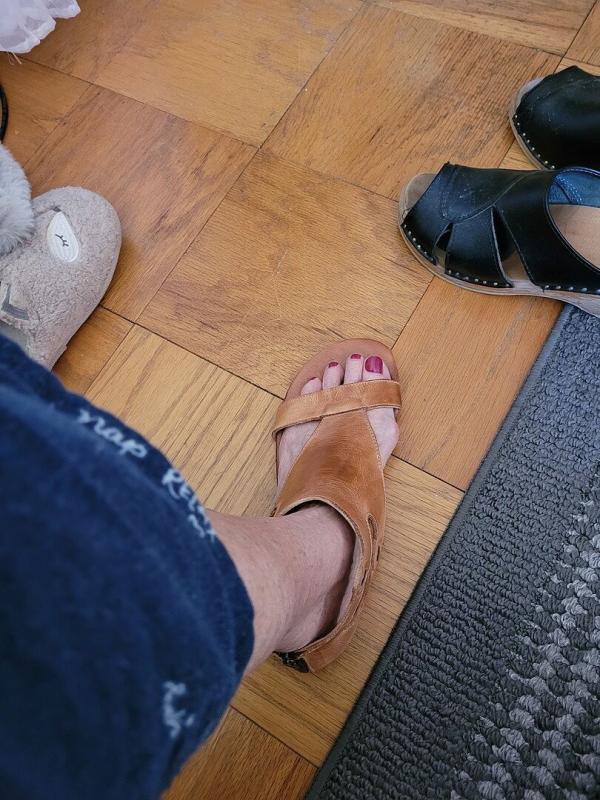 Customer photo for "Not happy with fit around"