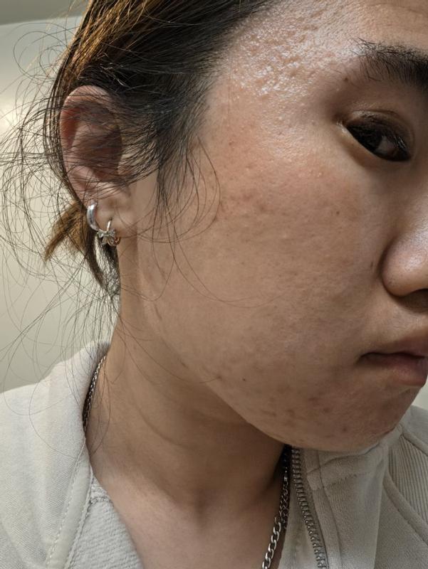 Review Thumbnail Image 0 384770942