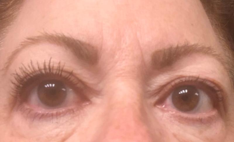 Before on right...after on left