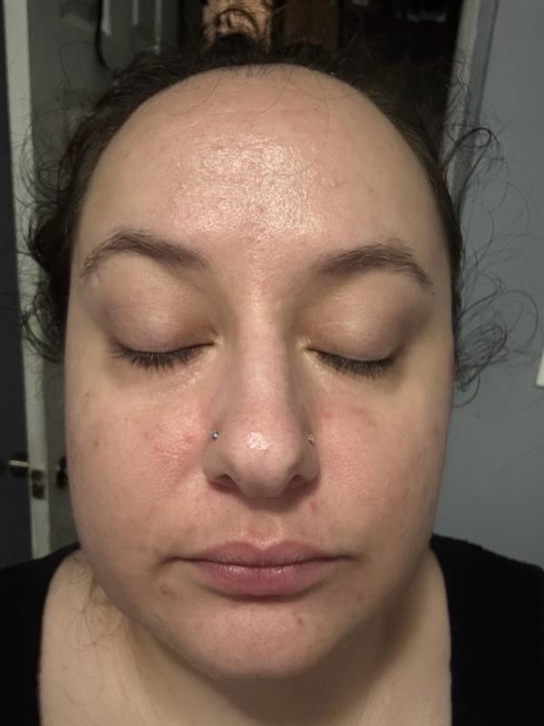 Review Thumbnail Image 2 379740469