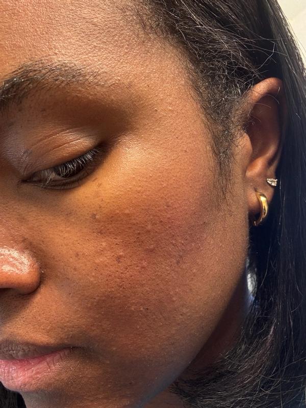 Review Thumbnail Image 0 383562195