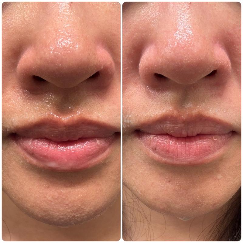 Review Thumbnail Image 0 382794411