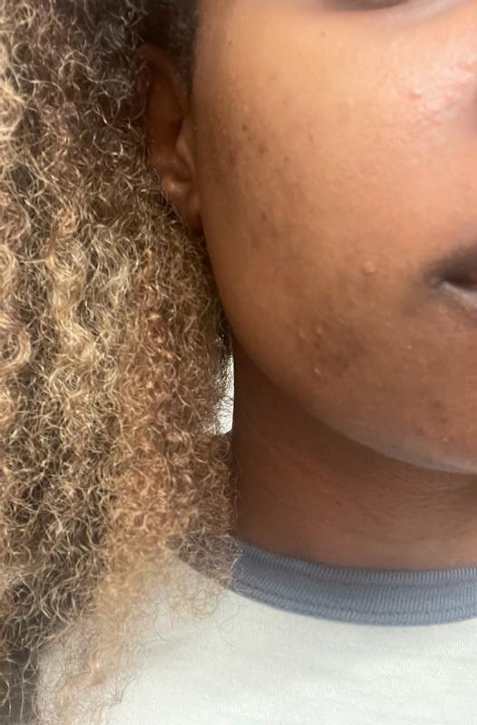 Review Thumbnail Image 1 382895110