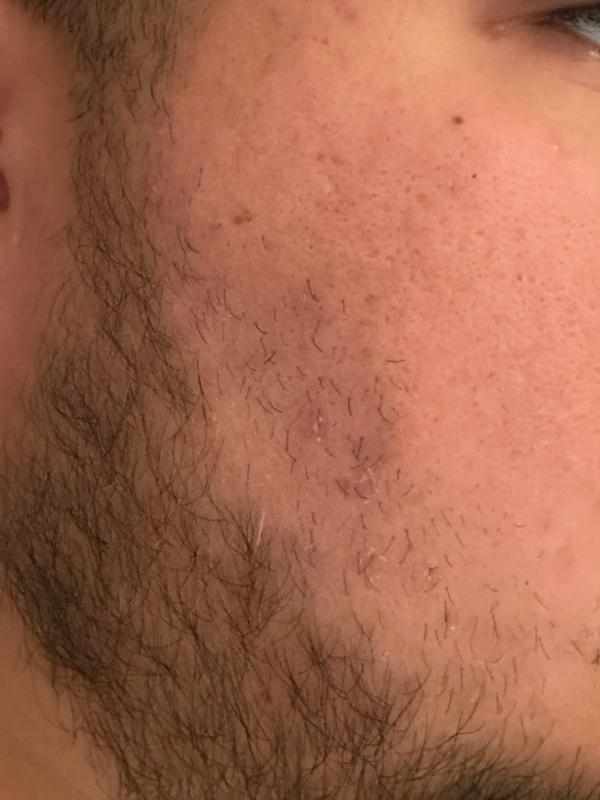 Review Thumbnail Image 1 379577905