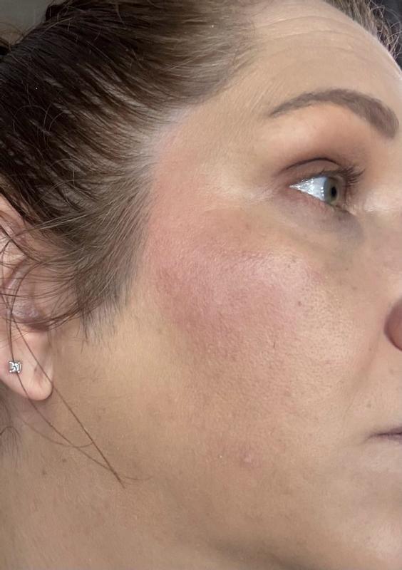 Review Thumbnail Image 0 385033833