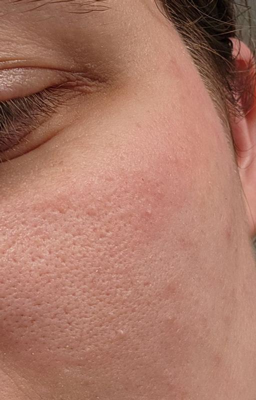 Review Thumbnail Image 0 385401662