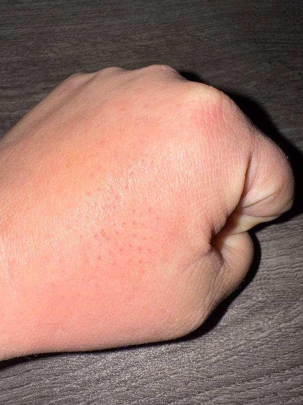 Review Thumbnail Image 3 385454850