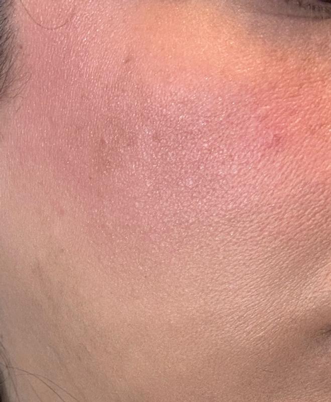 Review Thumbnail Image 1 382536531