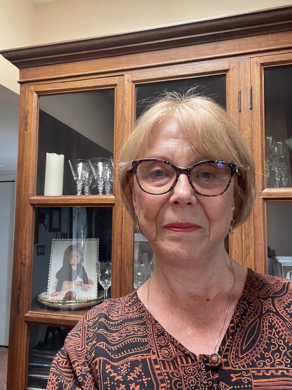 good skin at 76