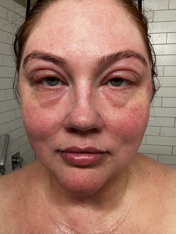 Eyes after using this serum