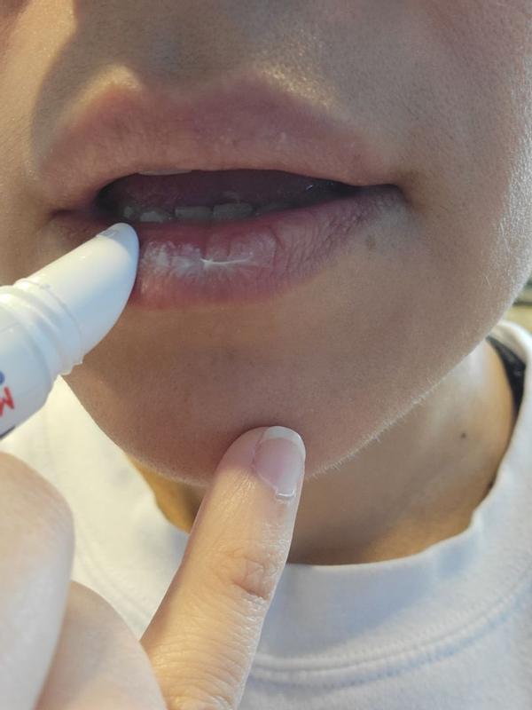 Medicated Lip Ointment Lip Protectant Blistex