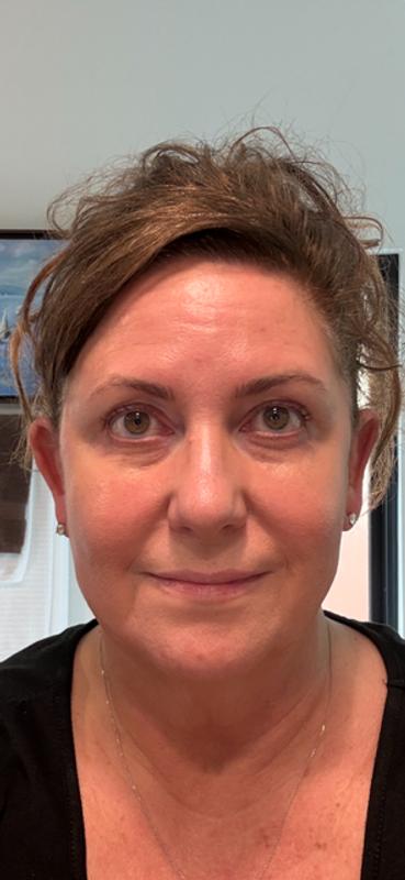 Me - No Makeup!