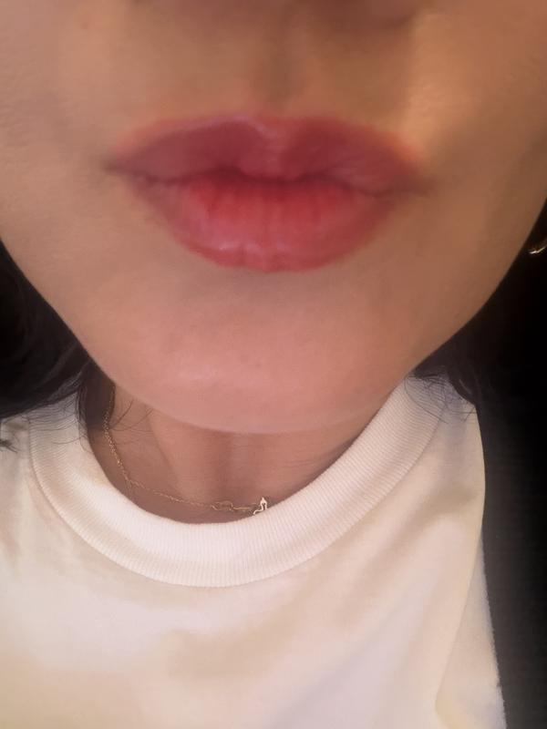 Customer carousel item 3.