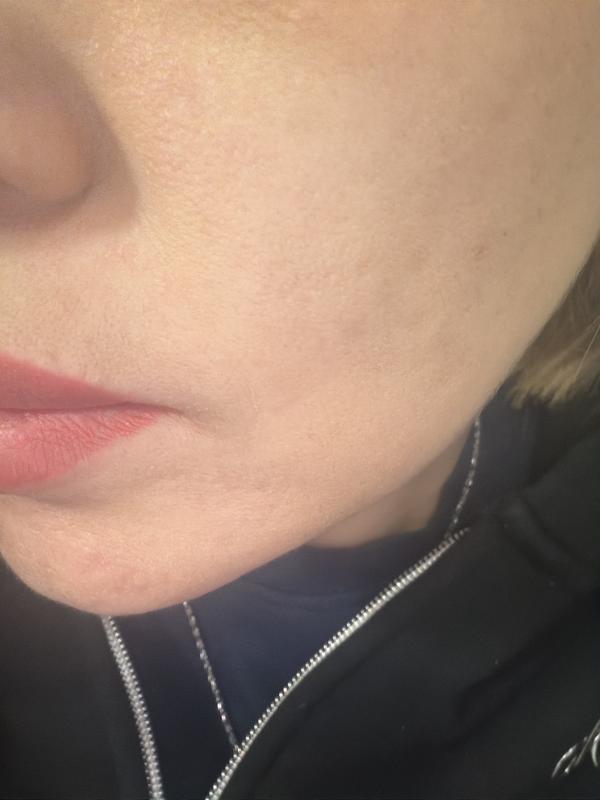 Customer carousel item 1.