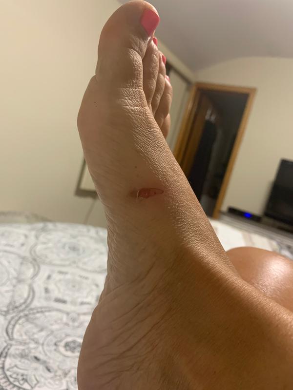 Gucci espadrille cut my feet