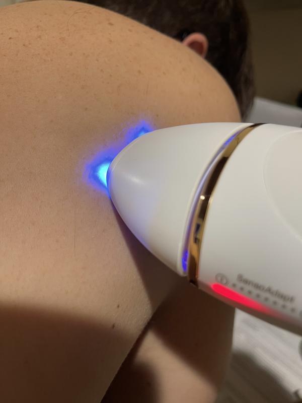 just zapped $50 off this Braun IPL hair removal tool — it's