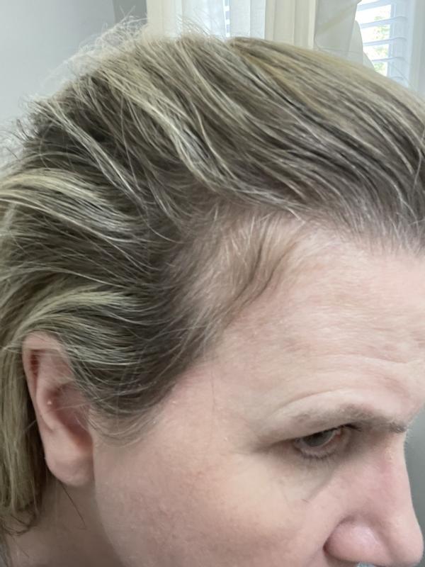 Customer photo for "Density Serum"