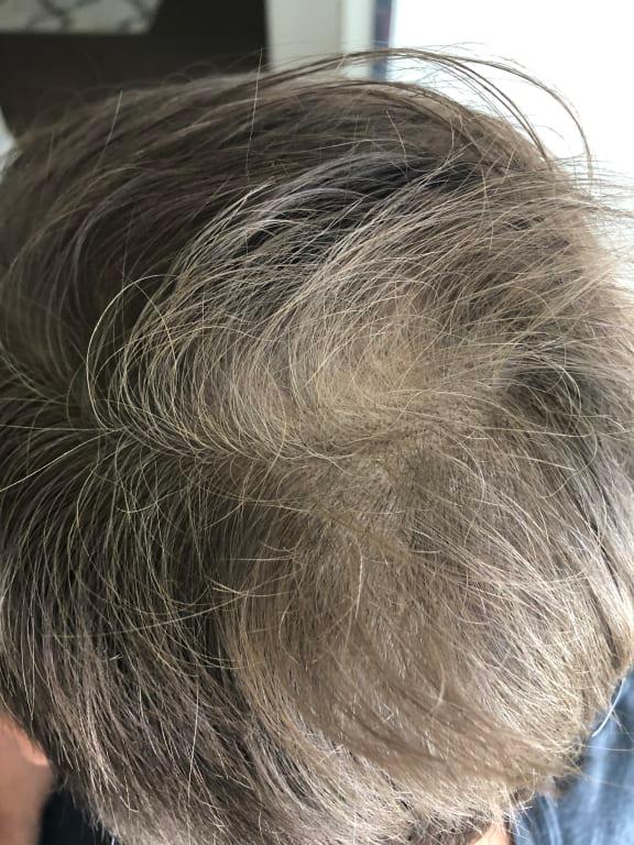 I put sea salt/hairspray in it after this picture to make it look more natural. So not spray close to the scalp or it will attach to every pore.