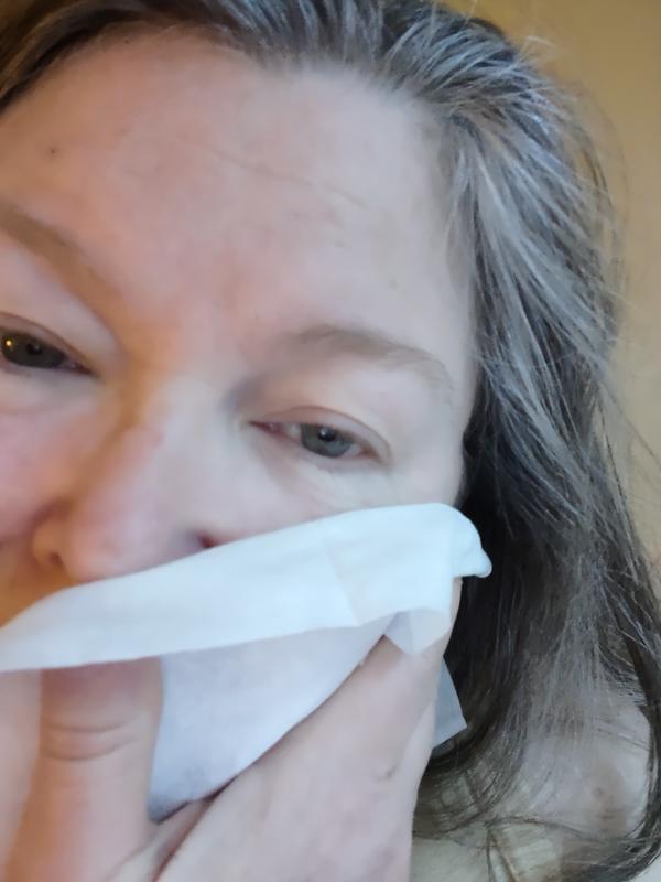 Photo from Mature skin