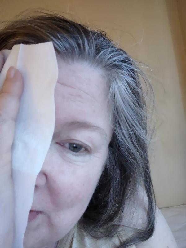 Photo from Mature skin
