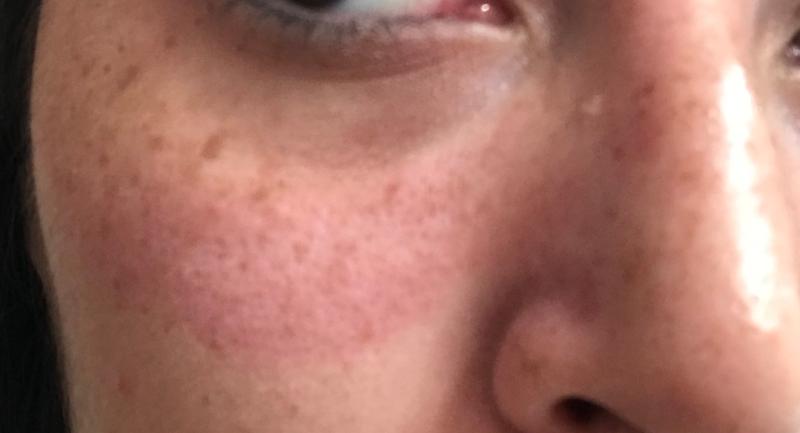 This happened on both sides