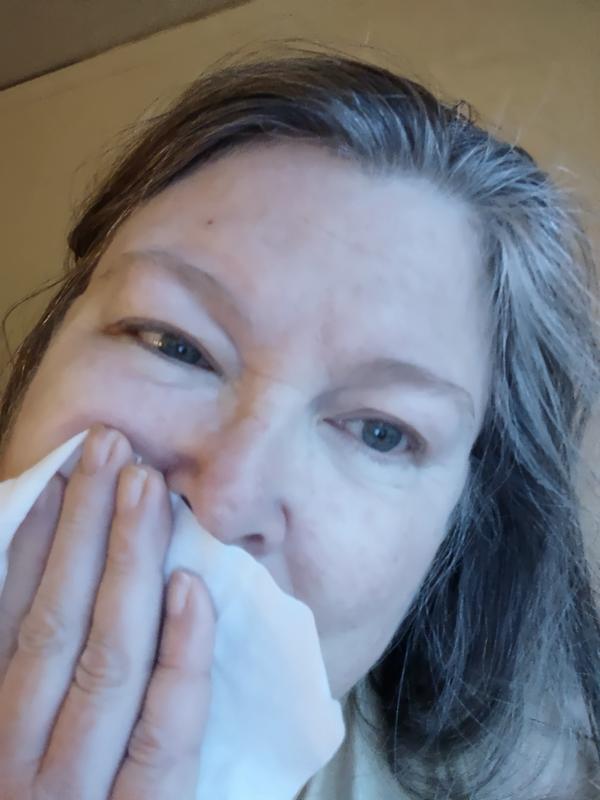 Photo from Mature skin