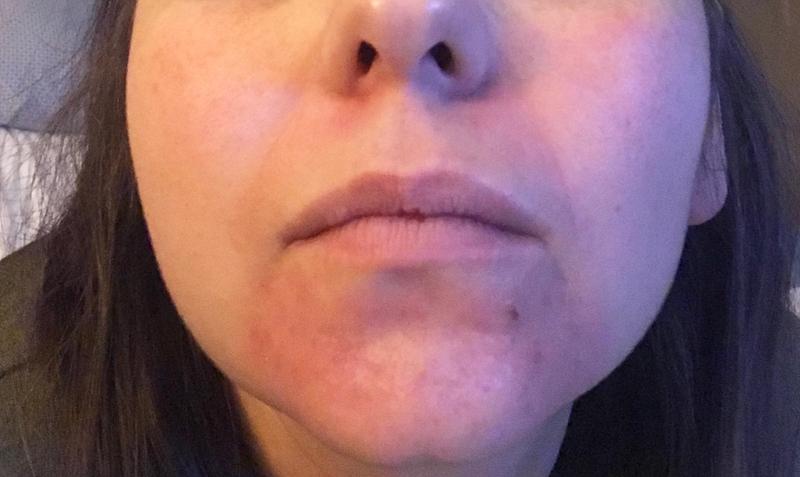 burt's bees micellar water wipes