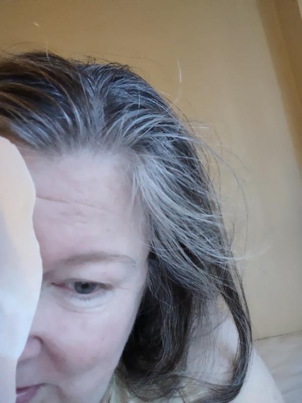 Photo from Mature skin