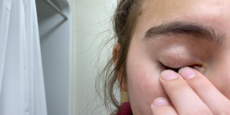 After using burt's bees cleanser for four days every night