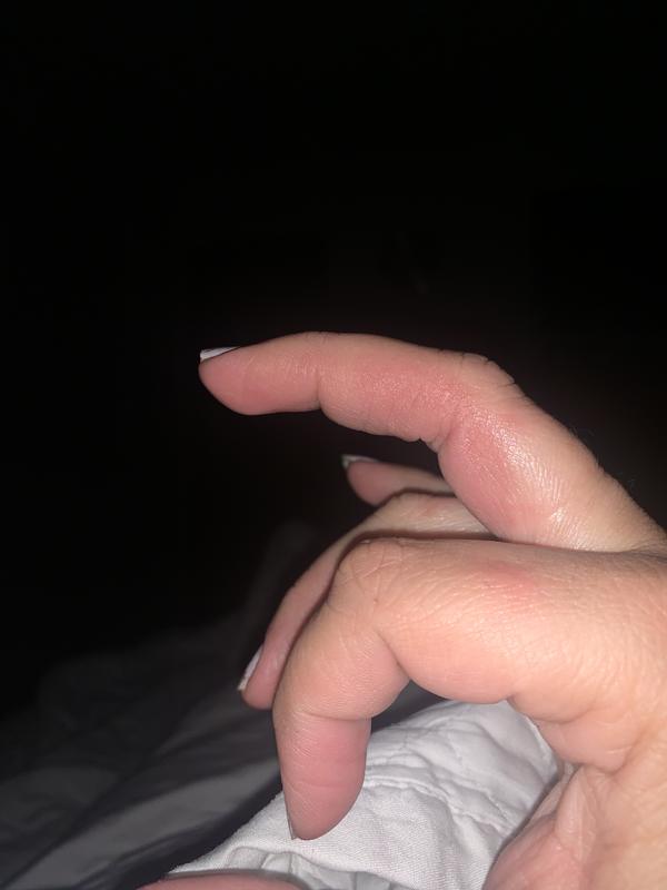 This was cracked and bleeding this morning and I started putting it on at 5pm and now it’s 1am and looks great