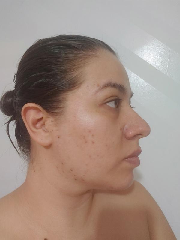 After 2 months of using the face cream