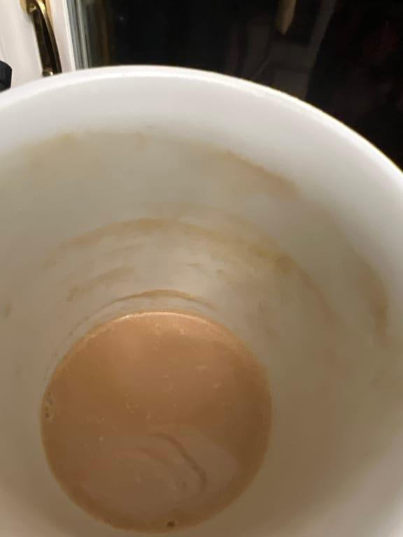 Scum ring (usually worse)