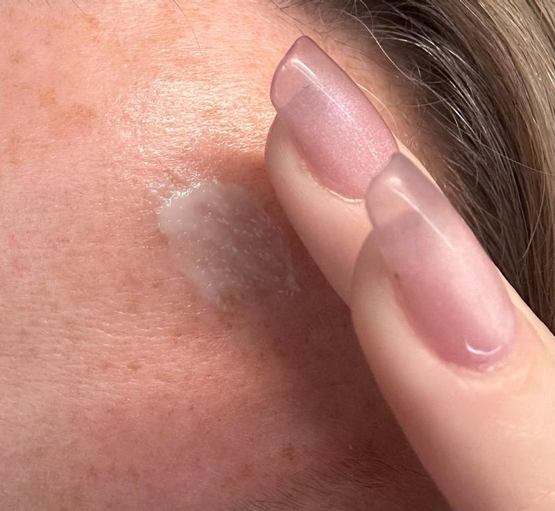 Customer photo for "Glowy skin, clean ingredients; but still have dark"
