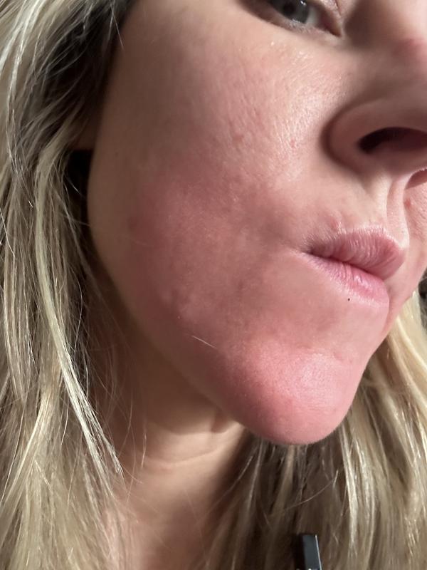 Customer photo for "Mmmm not sure"