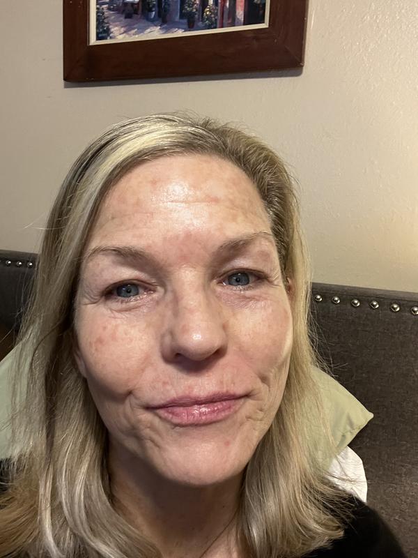 Customer photo for "New me."