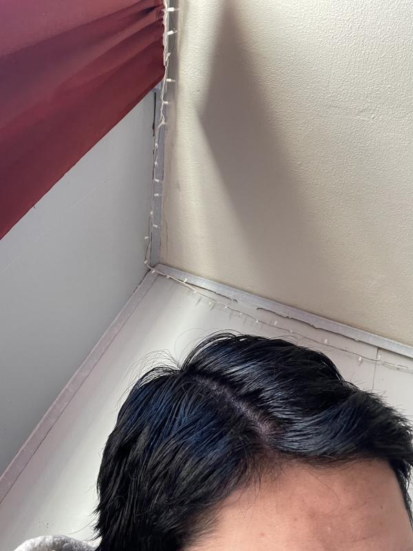 Going on 2nd week after 4 washes with Pantene