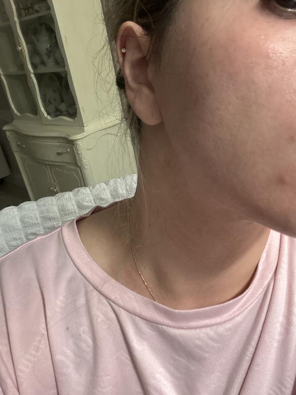 I have no makeup and a zit but it has helped my skin so much