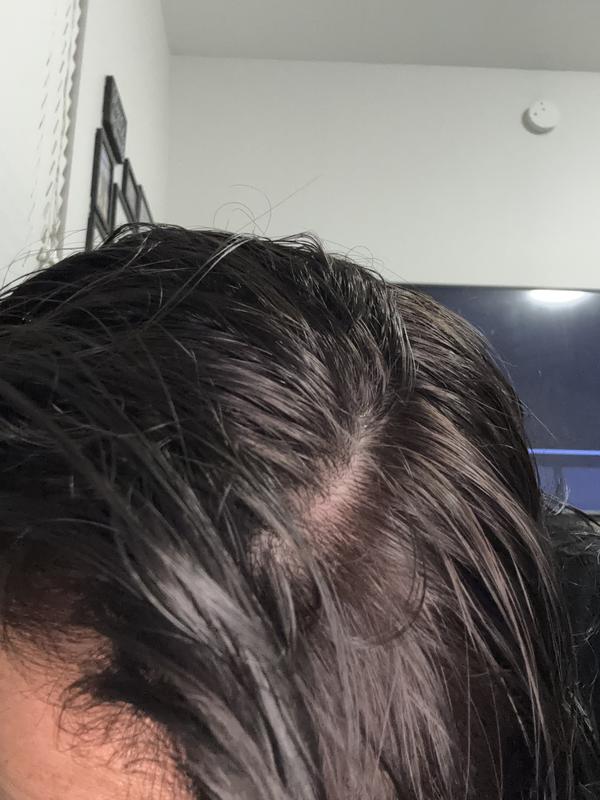 Cabello muy mal