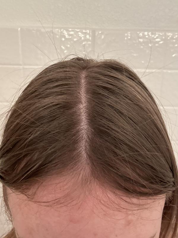 Oily hair
