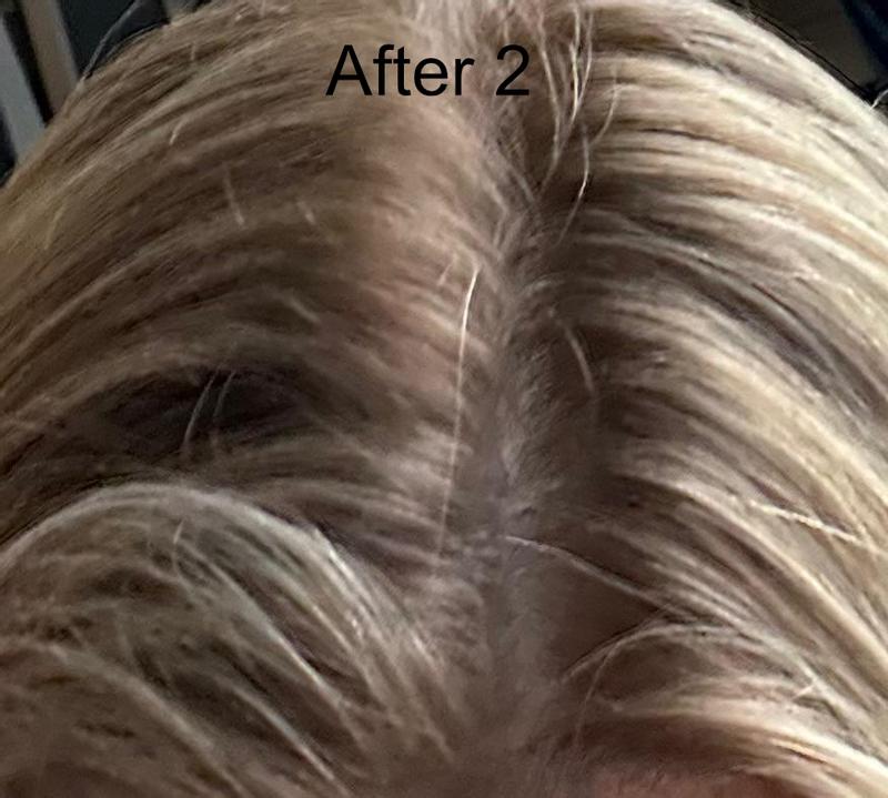 After 2